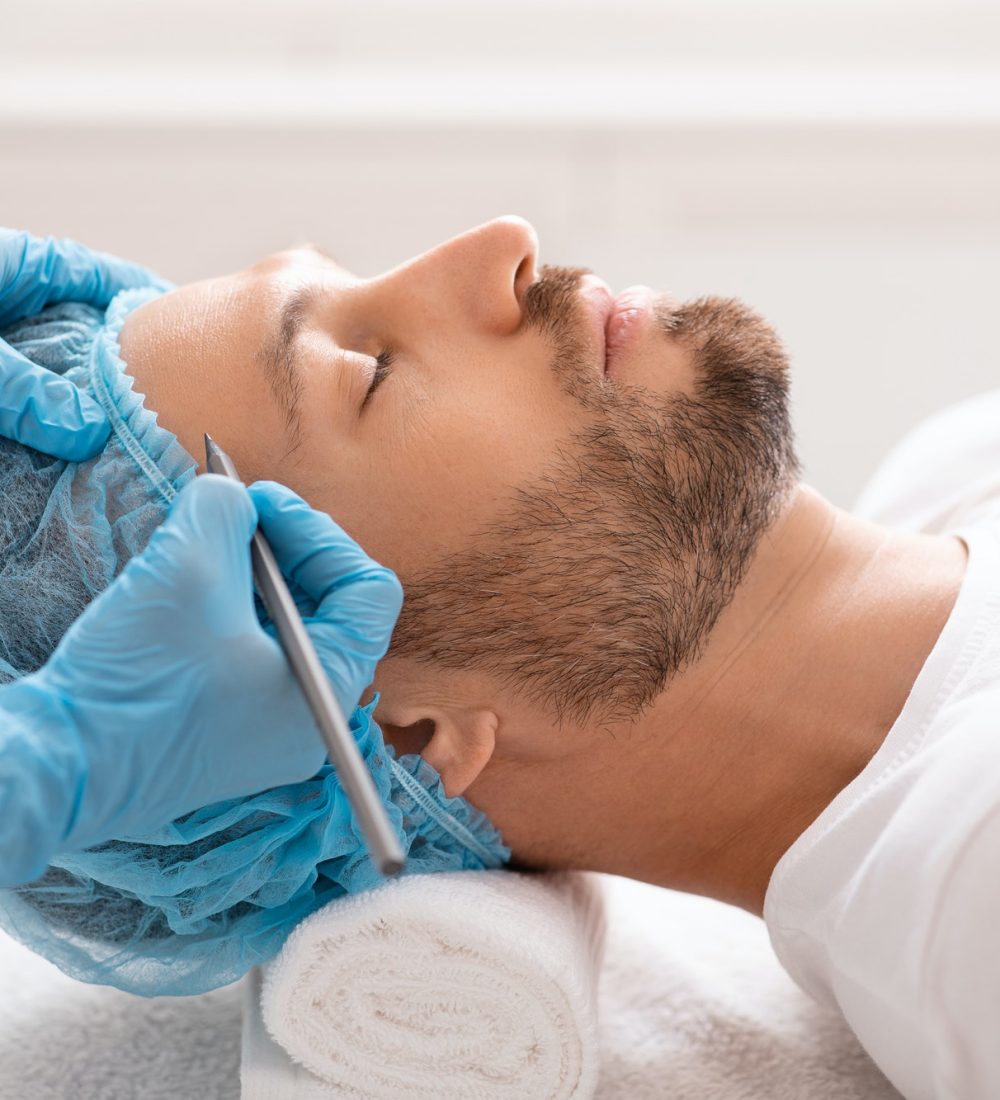 handsome-man-getting-pencil-marks-on-forehead-before-surgery.jpg